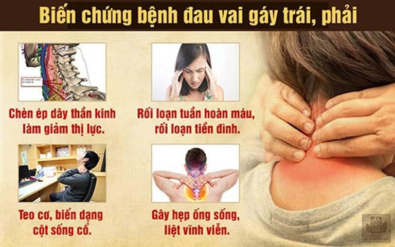 Health issues related to shoulder pain